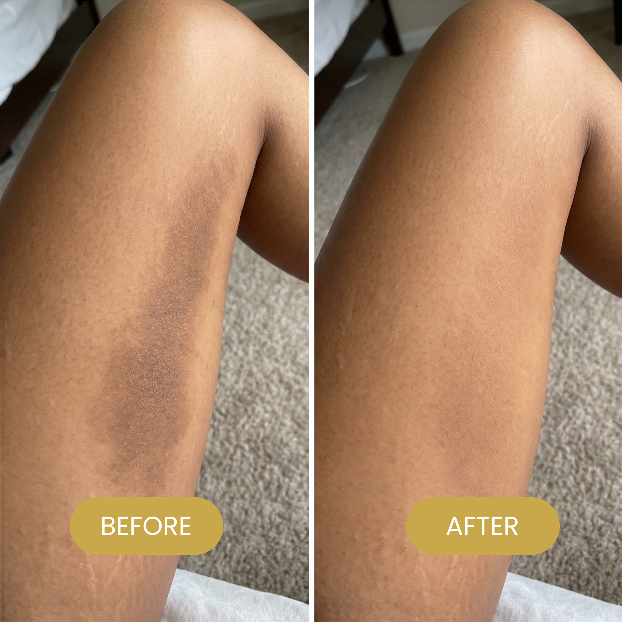 The Brightening Body Serum