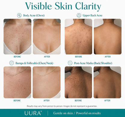 UURA Mandelic Acid Serum